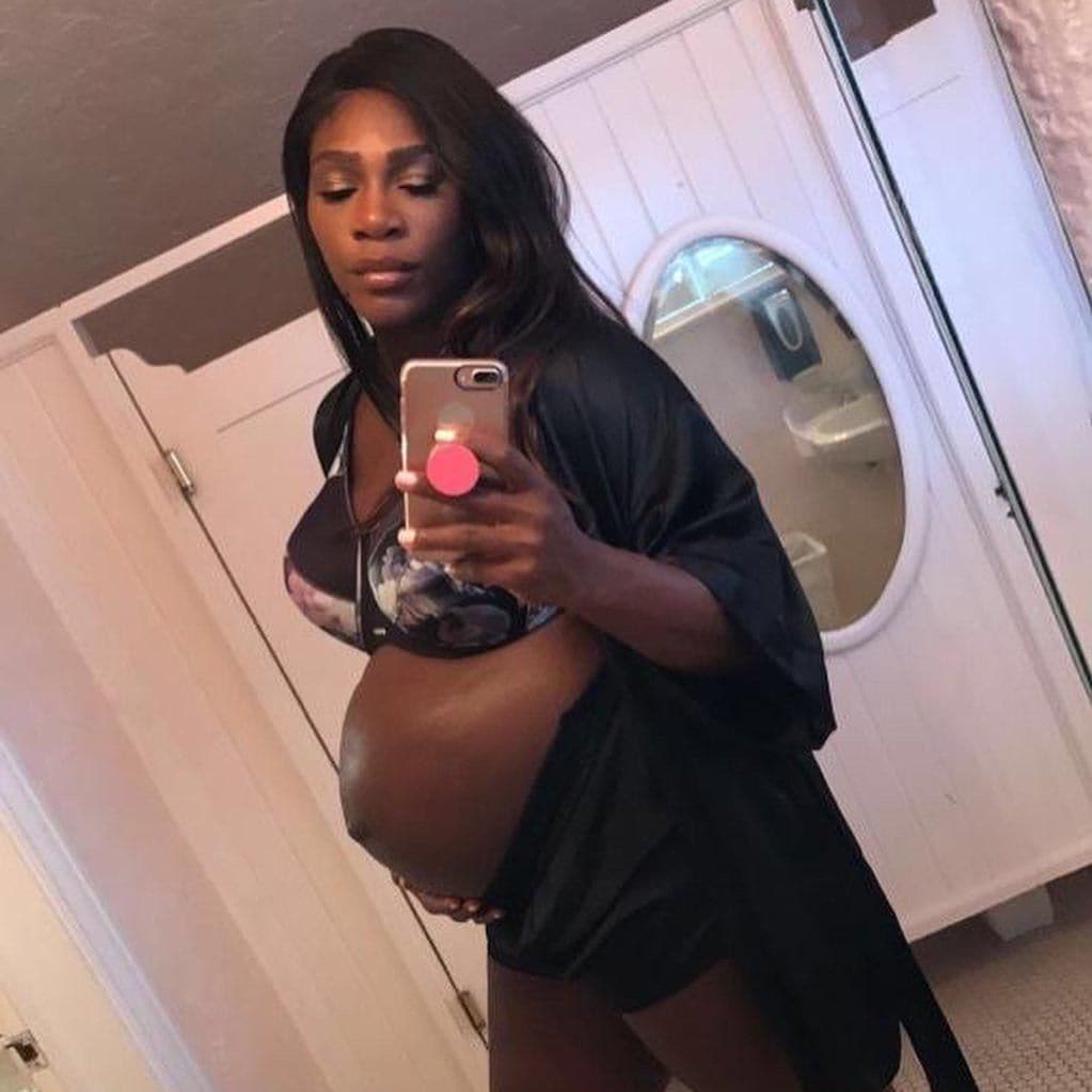 serena williams, baby bump