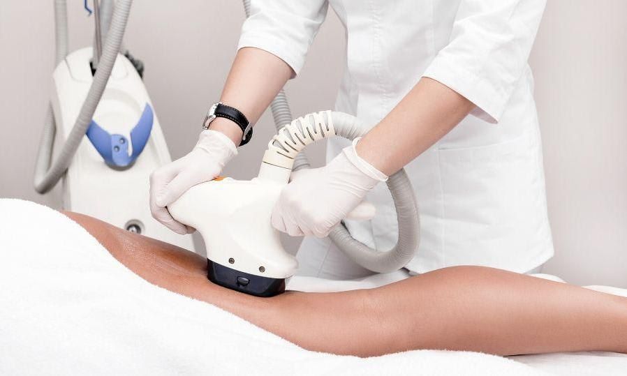 Cellulite removal radio frequency