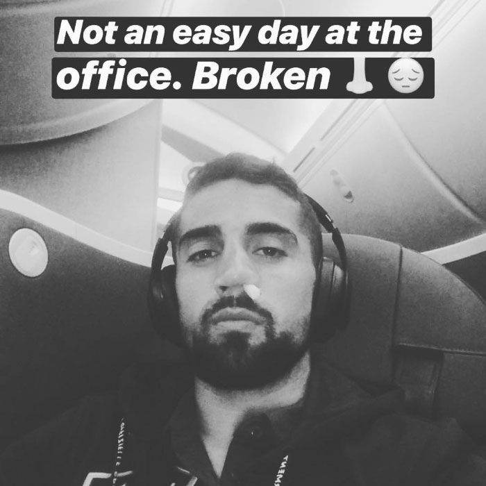 Sebastian Lletget broken nose