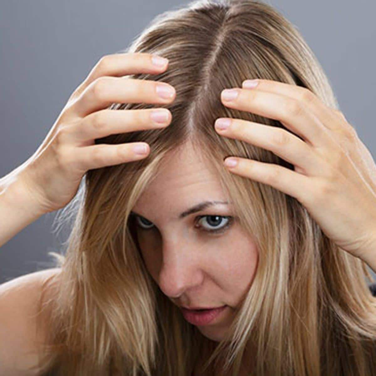 Woman touching her scalp