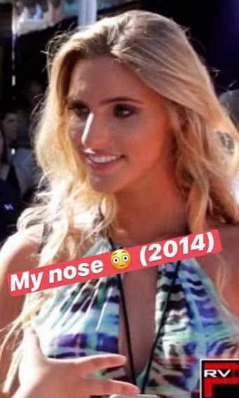 Lele Pons before cosmetic surgery