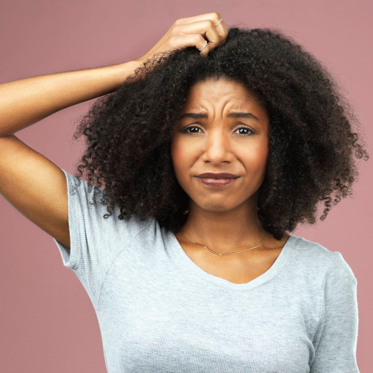 How does dandruff relate to stress? Experts weigh in on tips to treat ...