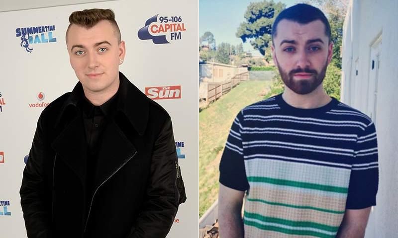 <a href="https://us.hellomagazine.com/tags/1/sam-smith"><strong>Sam Smith</strong></a>
<br>
Sam</strong></a> has lost over 40 lbs. in a year, which he has credited to the guidance of nutritional therapist Amelia Freer and her cookbook <i>Eat. Nourish. Glow</i>. The <i>Stay With Me</i> singer has showed off his dramatic transformation on social media, with many fans commenting that he is completely unrecognizable.
</br><br>
Photo: Getty Images