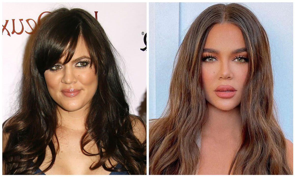 Khloé Kardashian before and after