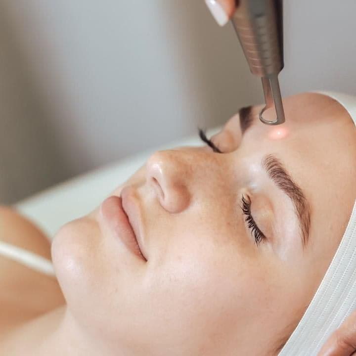 Laser Facials