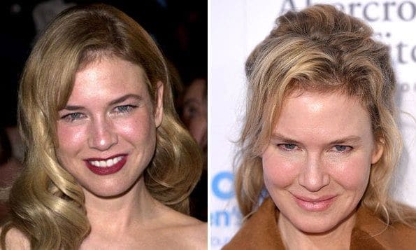 <a href="https://us.hellomagazine.com/tags/1/renee-zellweger"><strong>Renee Zellweger</strong></a>
<br>
Renee has undergone quite a transformation. Her changing appearance has drawn much comment from fans, but the <i>Bridget Jones' Diary</i> actress told <i>People</i>: "I'm glad folks think I look different! I'm living a different, happy, more fulfilling life, and I'm thrilled that perhaps it shows."
</br><br>
Photo: Getty Images