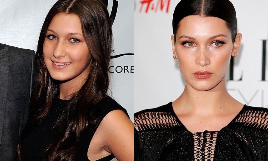 <a href="https://us.hellomagazine.com/tags/1/bella-hadid"><strong>Bella Hadid</strong></a>
<br>
Bella stunned fans when she shared a #throwbackthursday post of herself at 13, with many commenting that her face had changed dramatically over six years. While the model is keeping quiet about speculation that she may have had a nose job or lip fillers, there is no denying that Bella has blossomed into the model she is now.
</br><br>
Photo: Getty Images