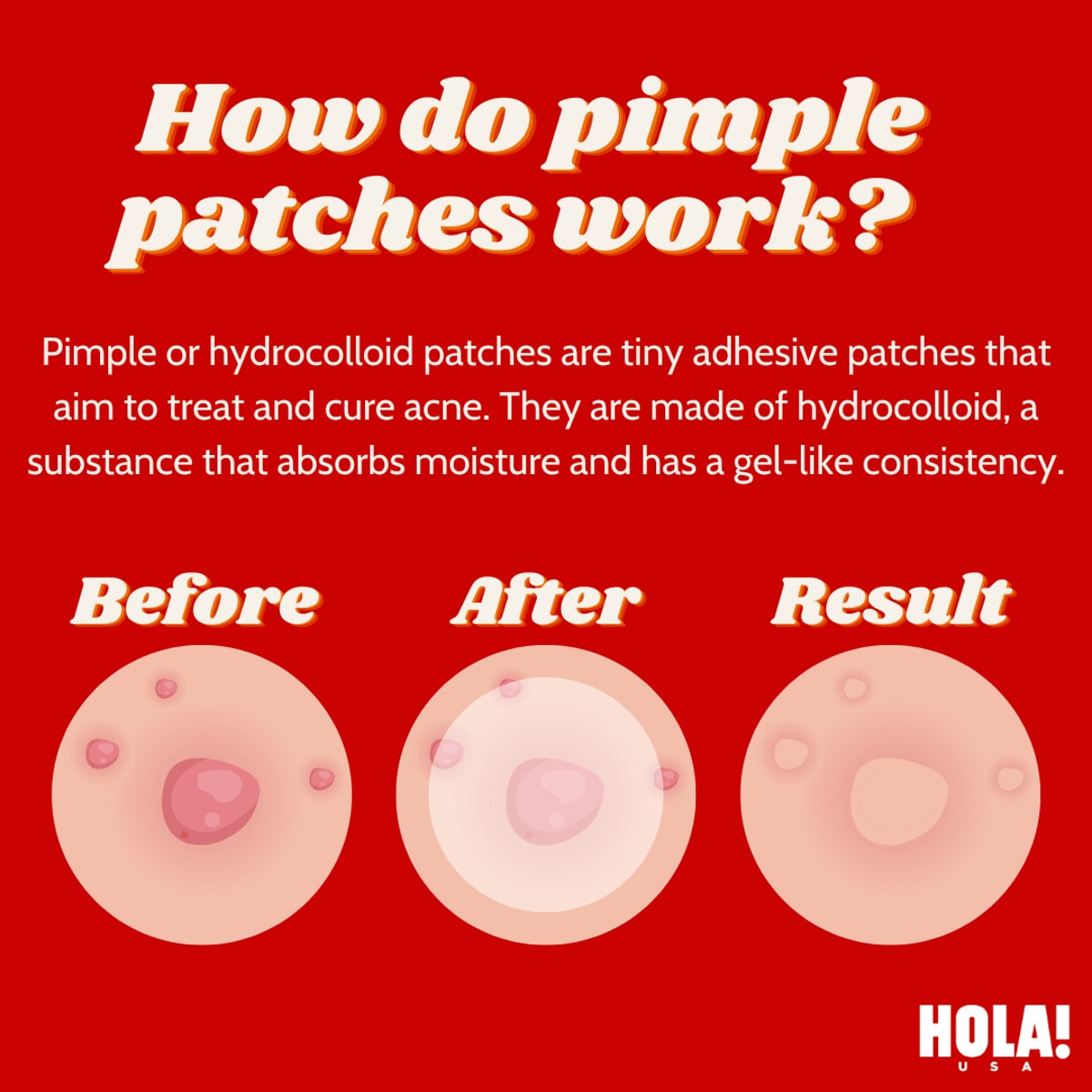 How do pimple patches work, and how to use them?