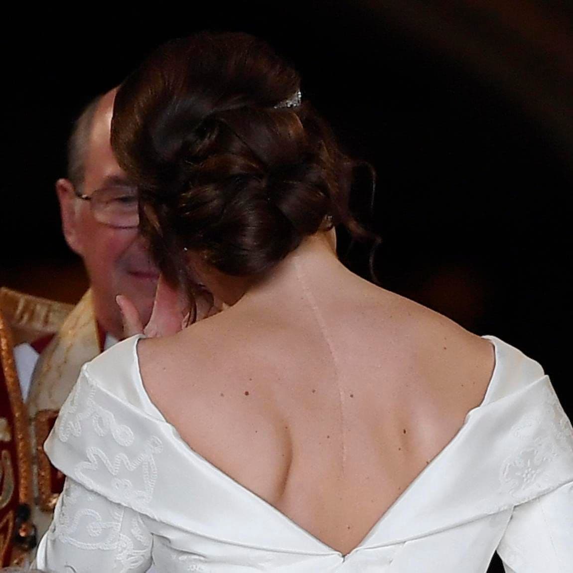 The Princess' scar was on display on her wedding day in 2018