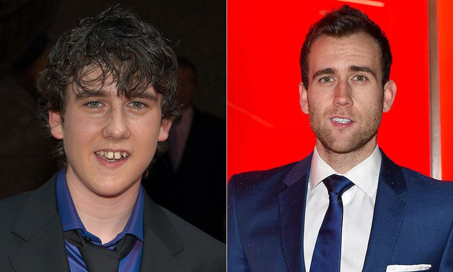 <b>Matthew Lewis</b>
<br>
Matthew was once known as the geeky character Neville Longbottom in the <i>Harry Potter</i> films, but has since transformed into a handsome young man. While Matthew has showed off his toned physique in photoshoots, he says he doesn't understand some of the attention he has received in recent years.
</br><br>
Of his dapper appearance at the premiere for the final Harry Potter film in 2011, Matthew said: "It was never meant to be a 'hey everyone, look at me!' but it was nice to be able to go and be myself. And then obviously a lot of attention focused on it, which I didn't expect at all. I've never considered myself to be good-looking at all. Just average."
</br><br>
Photo: Getty Images