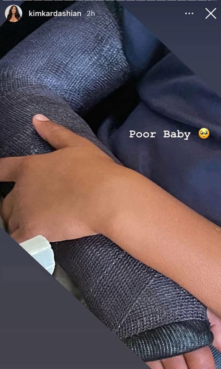 Saint West breaks his arm