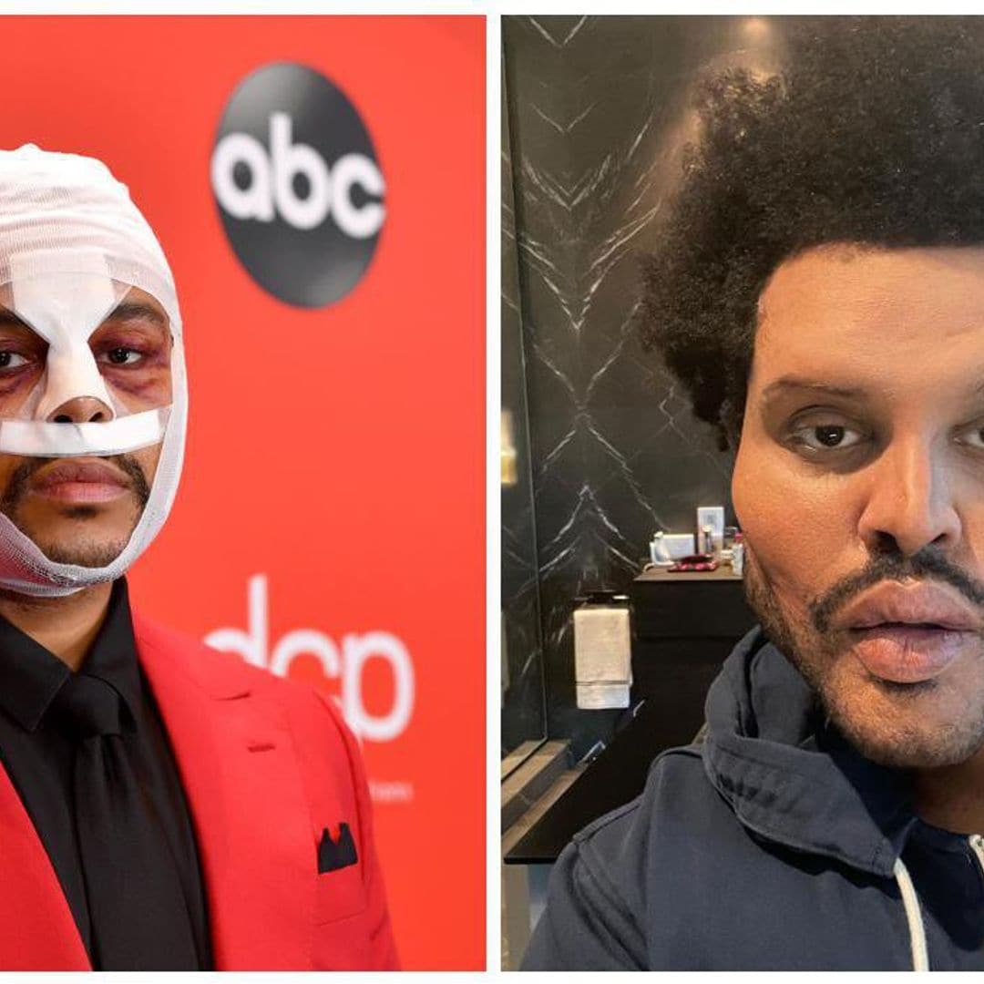 The Weeknd reveals his shocking new plastic surgery look fans call ‘Handsome Squidward’