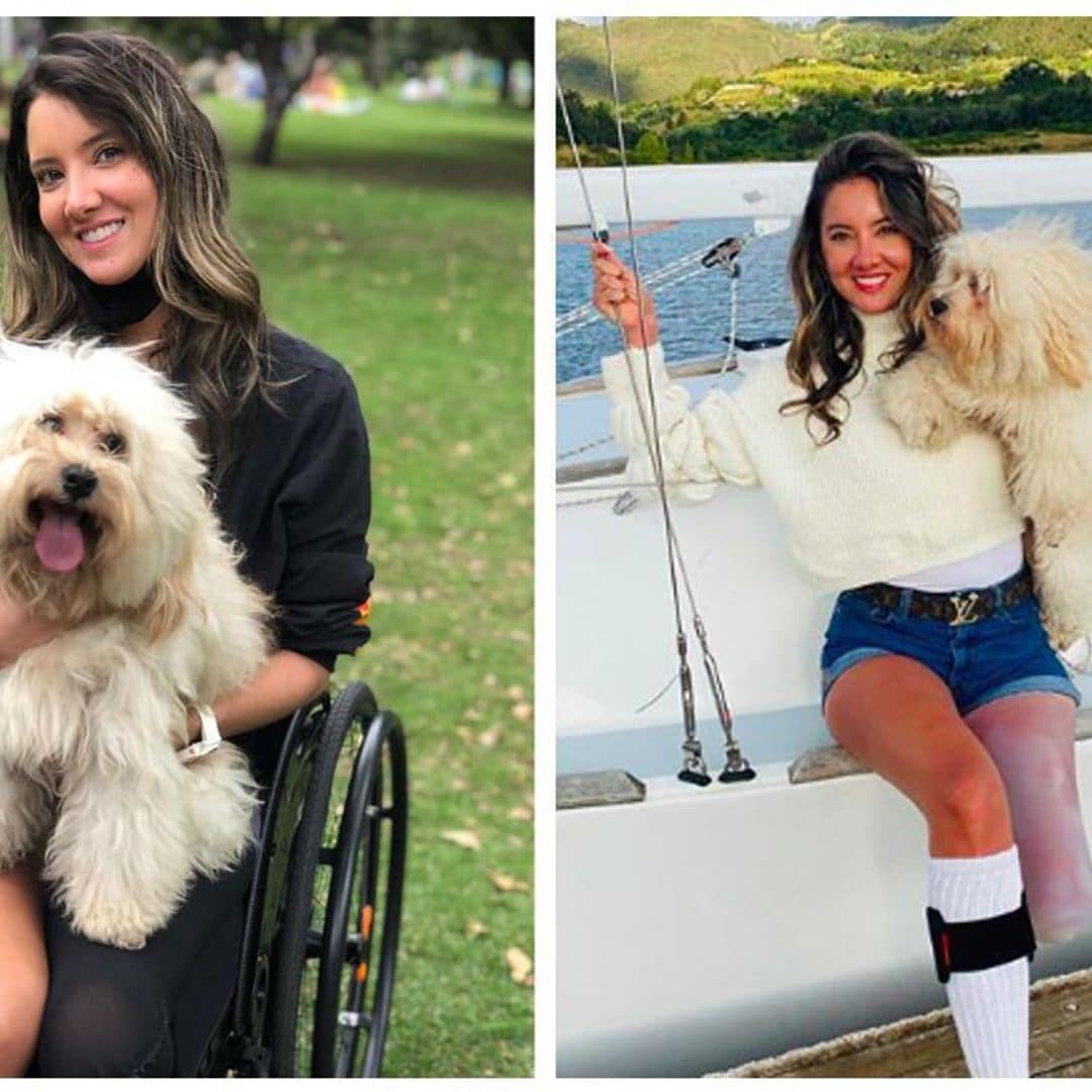 Daniella Alvarez confirms lack of mobility in her only foot