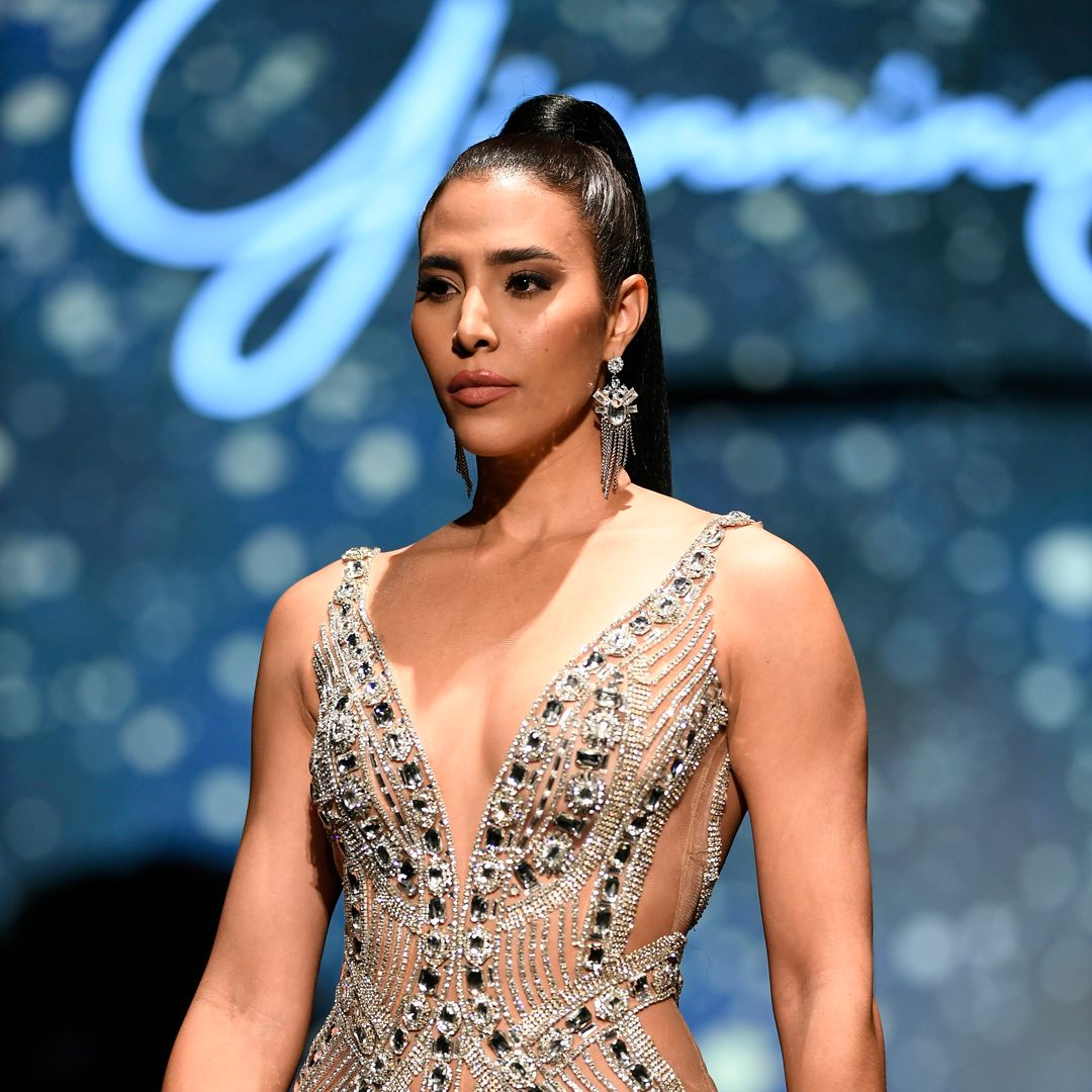 2021 Miss Dominican Republic reveals she suffered second-degree burns during pressure cooker explosion