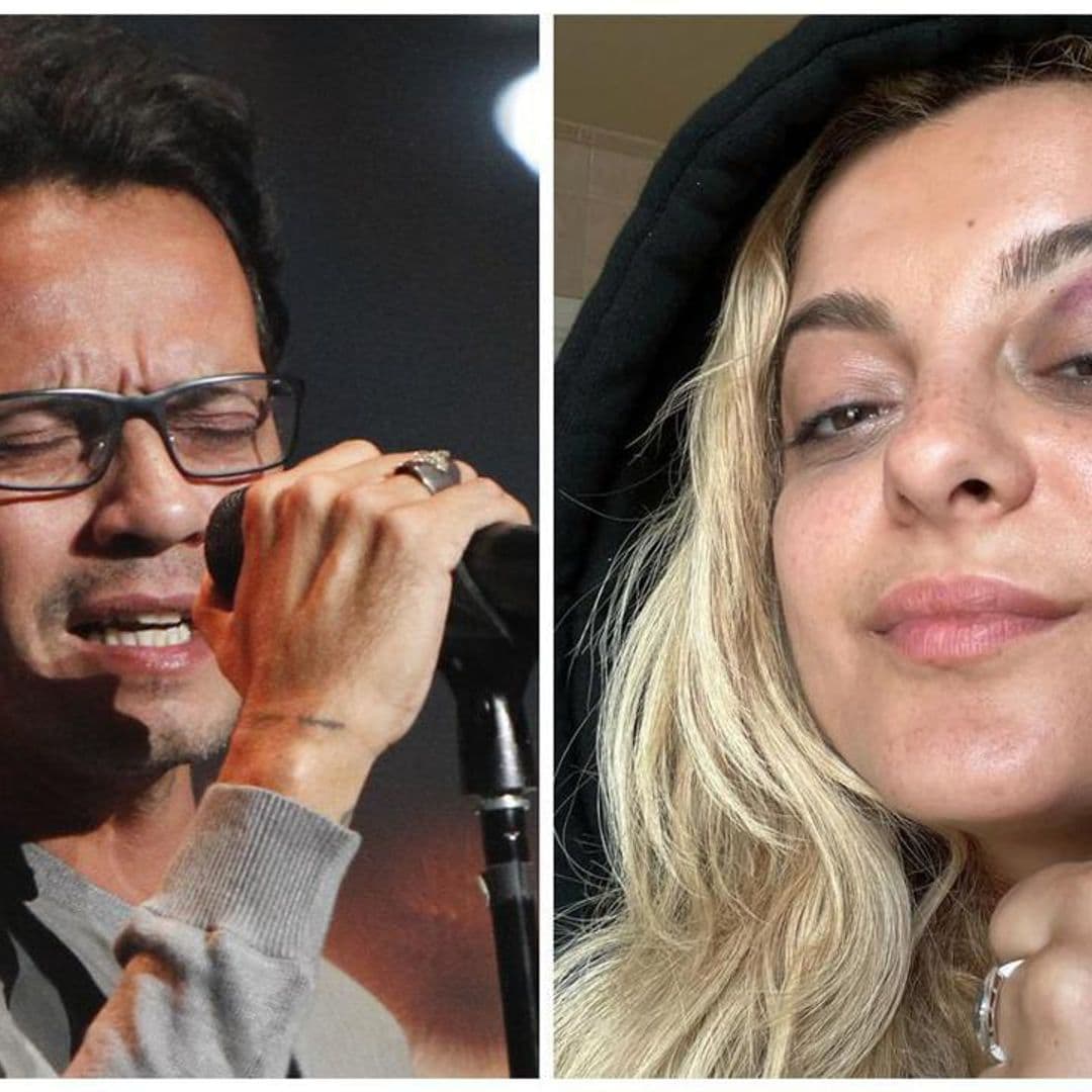 From Marc Anthony to Bebe Rexha: The stars who have got injured by fans throwing them items