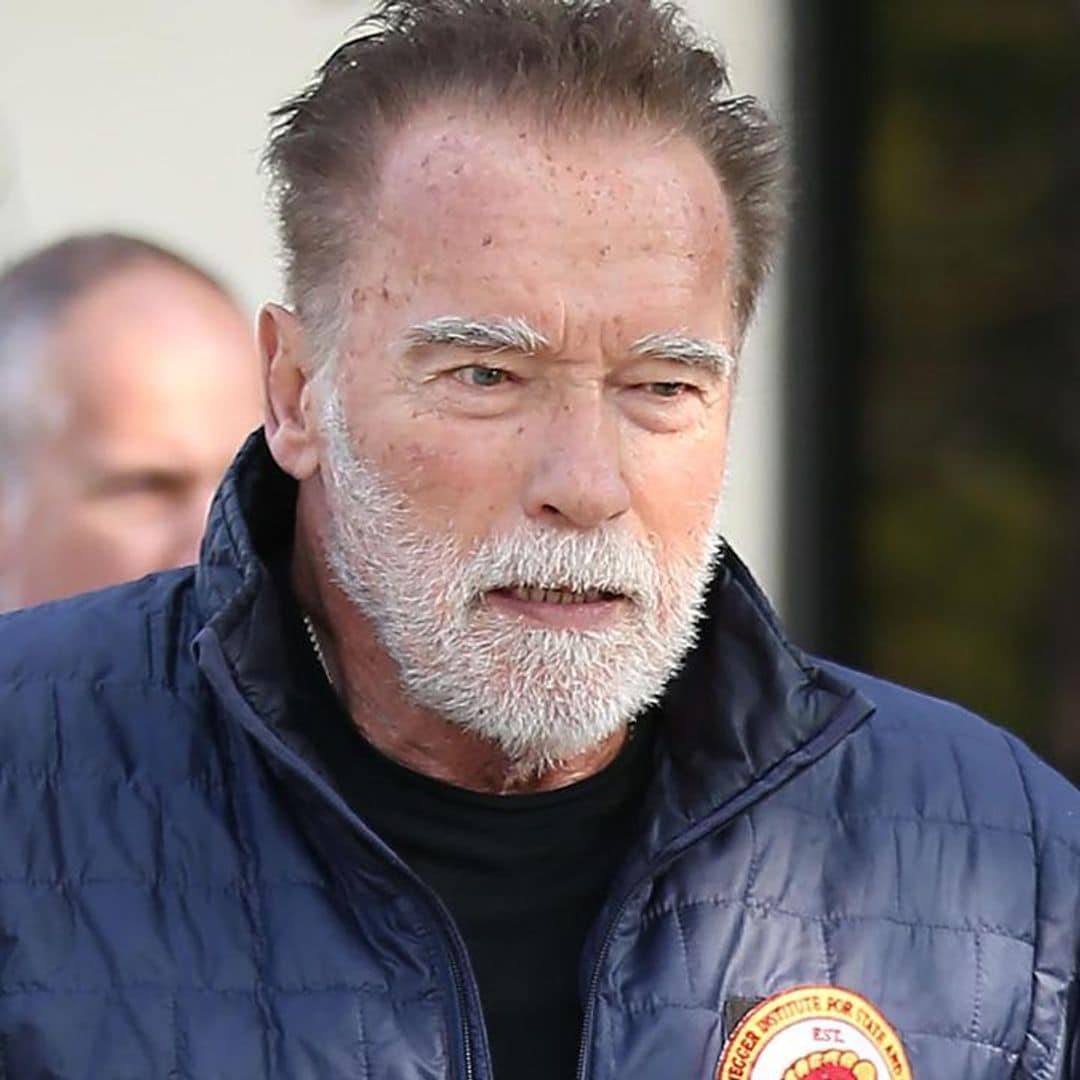 Arnold Schwarzenegger reveals he’s recovering from surgery