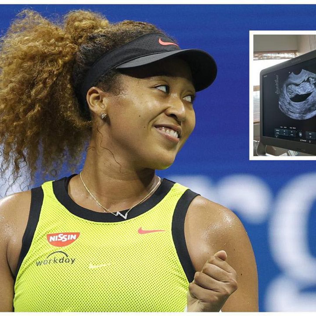 Naomi Osaka is pregnant! Athlete announces she won’t play in 2023