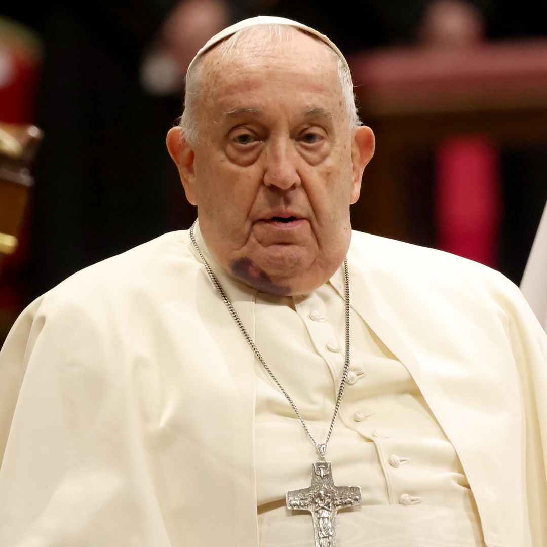 Pope Francis in critical condition after health decline