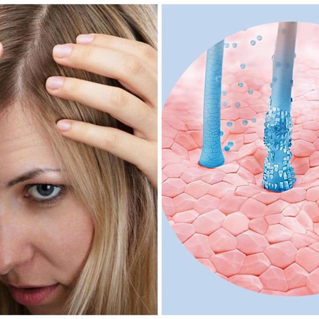 Dandruff, greasiness, or itchiness? Dr. Annie Gonzalez shares at-home scalp care remedies