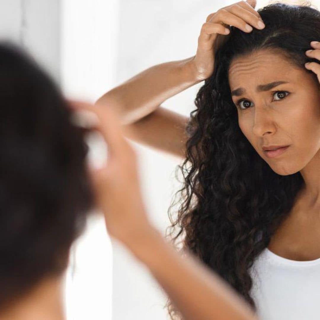 How do you know if it is Dandruff or Seborrheic Dermatitis?