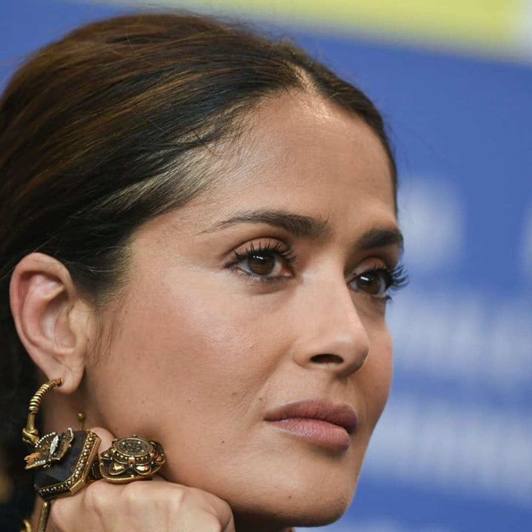 Salma Hayek posted a photo of herself recovering from an injury